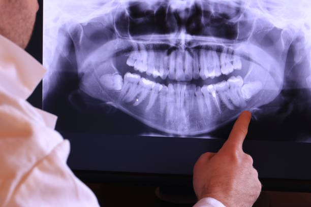 Best Walk-In Emergency Dentist in Foothill Farms, CA